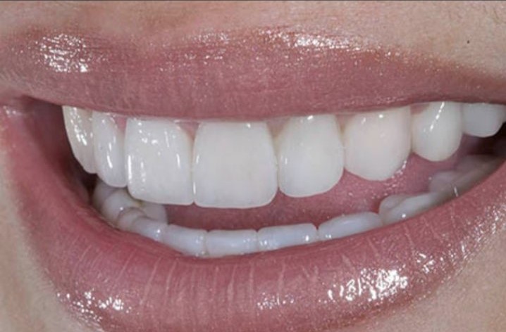 Aesthetic Dentistry