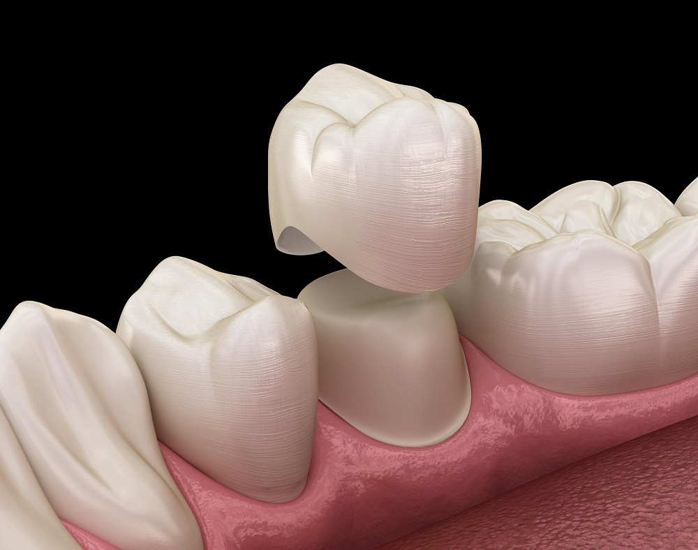 Prosthodontics & Implants